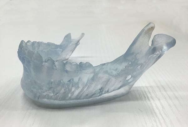 歯科歯の部分